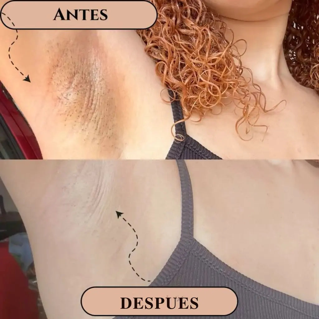 Petalov Crema Blanqueadora